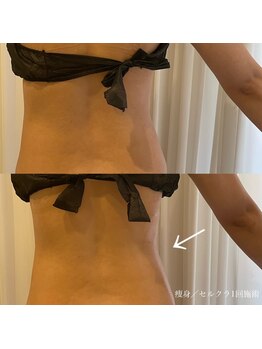 エクラ(eclat)/セルクラ