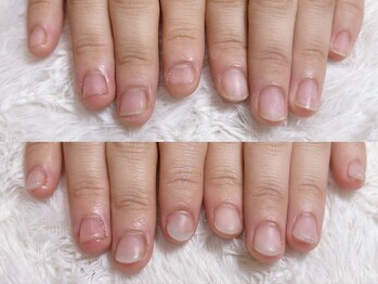 ココモ(cocomo)/深爪/自爪育成/フィルイン