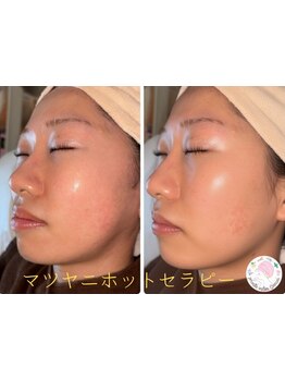 お肌をきれいにしたい