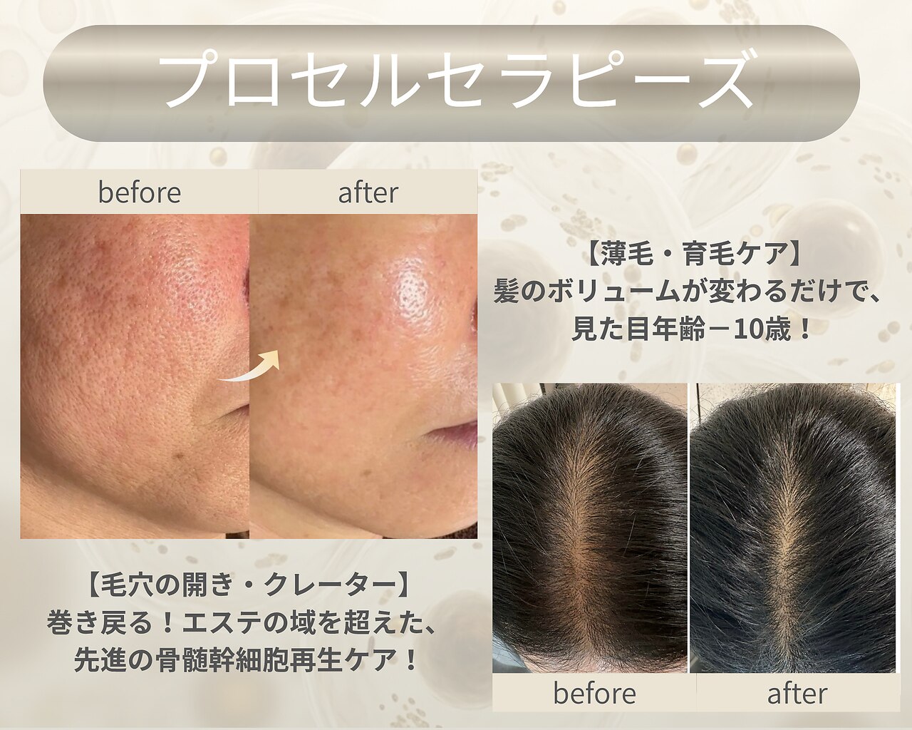ラグラス(Laglace)｜ホットペッパービューティー
