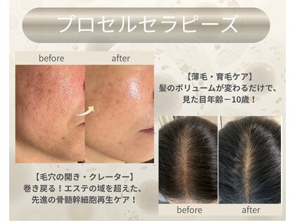 ラグラス(Laglace)の写真