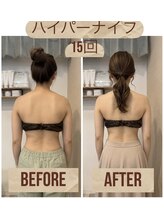ビボーン ボディ(美bone body)/ハイパーナイフで別人の後ろ姿