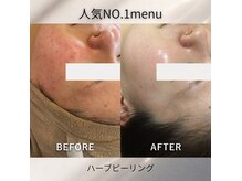 グランヴェルジェ(Granverger)の雰囲気（1年以上肌荒れでお悩みの方は是非ご来店ください！）