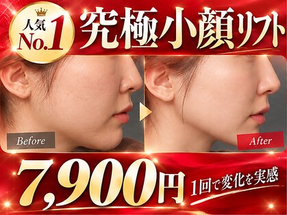 ミーティア(Meteor)の写真