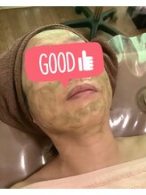 カレン/剥離しないハーブピーリング