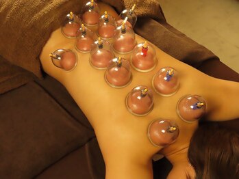 はり灸治療院 えがお/吸い玉療法