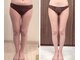 サロンドローヴ(Salon de LOAVE)の写真/【TVで話題!!】1台6役の最先端マシンで下半身の頑固な脂肪を根こそぎ燃焼! 下半身集中ケア