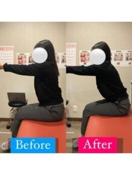 ナオル整体 宮崎院(NAORU整体)/20代女性施術事例【反り腰改善】