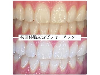 ホワイトニングルーム 川崎店(WhiteningRoom)/ホワイトニング/川崎