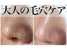 ルネッタ(Lunetta)