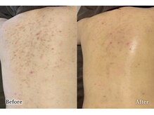 アネル 新都心店(anel)/