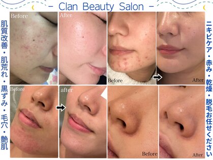 クラン 森ノ宮店(Clan)の写真