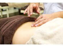 ゆずりは鍼灸整骨院/鍼