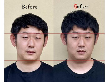 アプロ(APLO)/自律神経調整+姿勢矯正