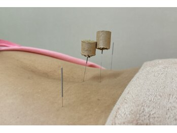 命水鍼灸院/腰痛【新宿/鍼灸】