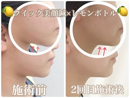 アキュモンド 渋谷院(acumond)の写真