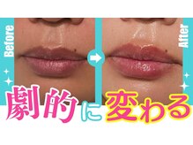 アン 銀座(ann)/唇ケア