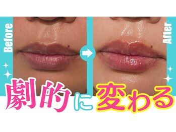 アン 銀座(ann)/唇ケア