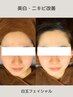 【美白肌】SNSで超話題☆極上白玉フェイシャル