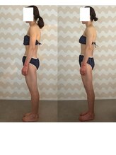 トリムリターン 三重伊賀店Mana/姿勢・ゆがみ整い、むくみにも