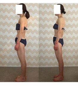 トリムリターン 三重伊賀店Mana/姿勢・ゆがみ整い、むくみにも