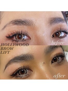 ラナ バイ アンドライフ ショウナン(Lana by andlife Shonan)/HBL ハリウッドブロウリフト