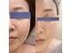 リッチベル(richbelle)の写真
