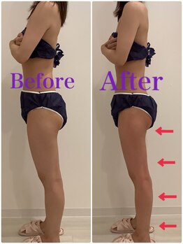 スペチアーレ 夙川/ハイパーナイフで脚長に