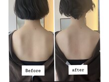 リモド(Rimodo509)/肩甲骨はがし（リンパマッサージ