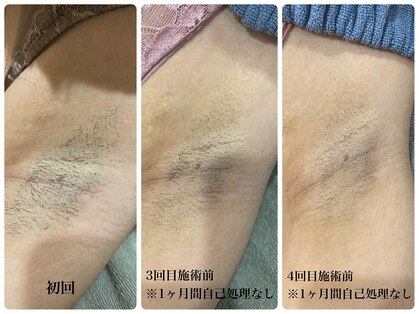 ビビッド(BiBiD)の写真