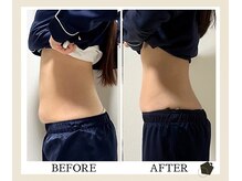 サンク(Cinq)の雰囲気（美容家に大人気◆腸もみ ダイエット/リンパマッサージ/痩身）