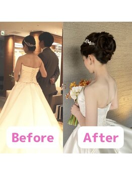 ボディキュア ブライダル美容整体 大阪梅田/まるで別人級に★/大阪/北新地