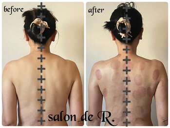サロン ド アール(salon de R.)/【お背中骨氣・50代・施術効果】