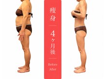 ムーン(MOON)/痩身全身before→after