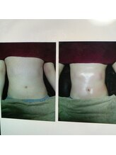 ムーブ(MOVE)/お腹