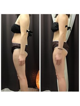 まほろば鍼灸整骨院 美骨痩身ベルナ(BELUNA)/ダイエットは最新痩身機器で♪