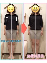 なぎさ整骨院/産後骨盤矯正10回目