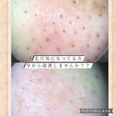 メナードフェイシャルサロン 西区八筋町店