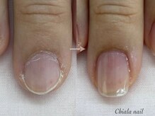 キアラネイル(Chiala nail)の雰囲気（ちび爪など、ジェル・アクリルを使わずに美しい縦長な爪に！！）