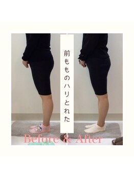 スタイルラボ高松/産後骨盤矯正の効果♪