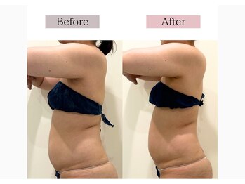 フロリール アザブジュウバン(FlorirAzabujuban)/痩身/脂肪燃焼/くびれ美人