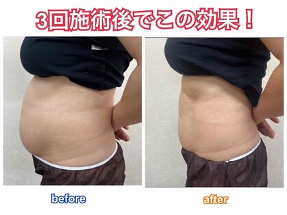 エルミューノ(elμno)の写真