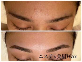 エピファニー(Epi phany Total Beauty Salon)/【ニキビケア/すっぴん自信肌】