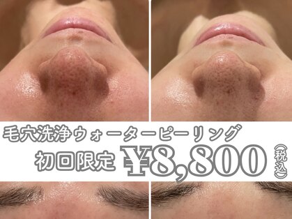 イデアルミー 大宮店(イデアルMe)の写真