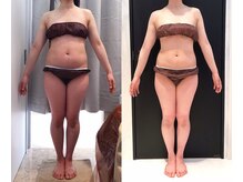 リボディ 表参道(An re Body)/before→after