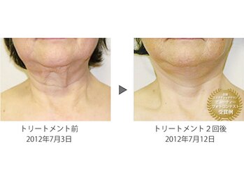 酵素風呂 めぐみ/サーモシェイプ・顔