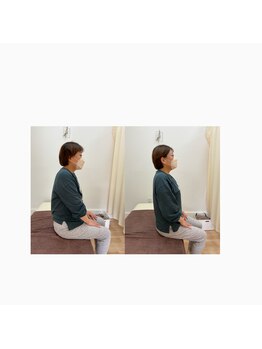 鍼灸整骨院ACT/姿勢改善