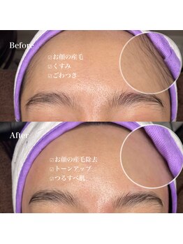 リア 自由が丘(REA)/マリムーブフェイシャルワックス