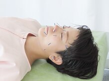 明大前はり灸院/学生さんに人気の美容鍼