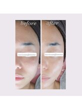 ラヴィソンファム(Ravissant femme)/30代フェイシャル